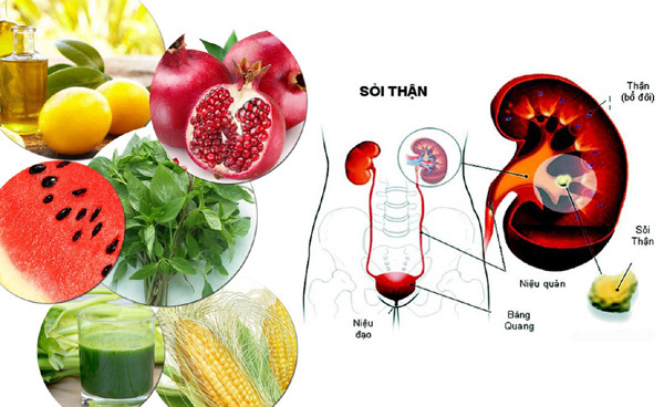 Đồ Uống Giúp Ngăn Ngừa Sỏi Thận